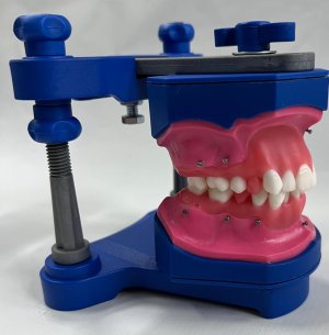 FANTASTIC ORTO - SEGUNDO CASO (TYP047)