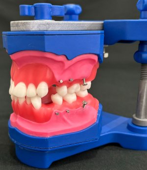 AVANCE - PROF MARCIO BASTOS (TYP006)